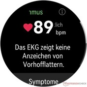 Ergebnis EKG-Funktion